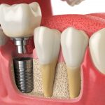 Основы стоматологии: от здоровья зубов до красивой улыбки